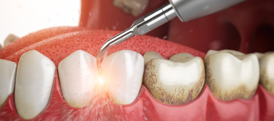 What Is a Periodontist? | Bay Dental