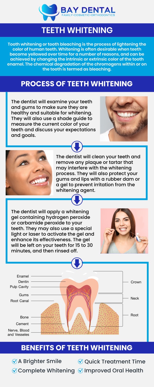 Explore personalized teeth whitening treatments designed to brighten your smile and improve confidence. Dr. Linda Pearce, DDS, provides customized cosmetic dental care focused on safe, effective, and natural-looking whitening results. For more information, contact us or request an appointment online. We are conveniently located at 3620 S. Bristol St, #307, Santa Ana, CA.