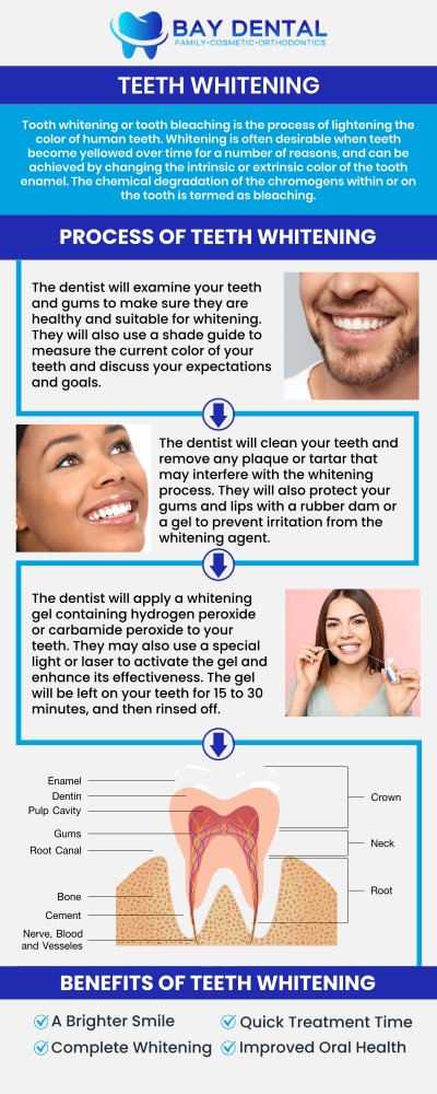 Explore personalized teeth whitening treatments designed to brighten your smile and improve confidence. Dr. Linda Pearce, DDS, provides customized cosmetic dental care focused on safe, effective, and natural-looking whitening results. For more information, contact us or request an appointment online. We are conveniently located at 3620 S. Bristol St, #307, Santa Ana, CA.