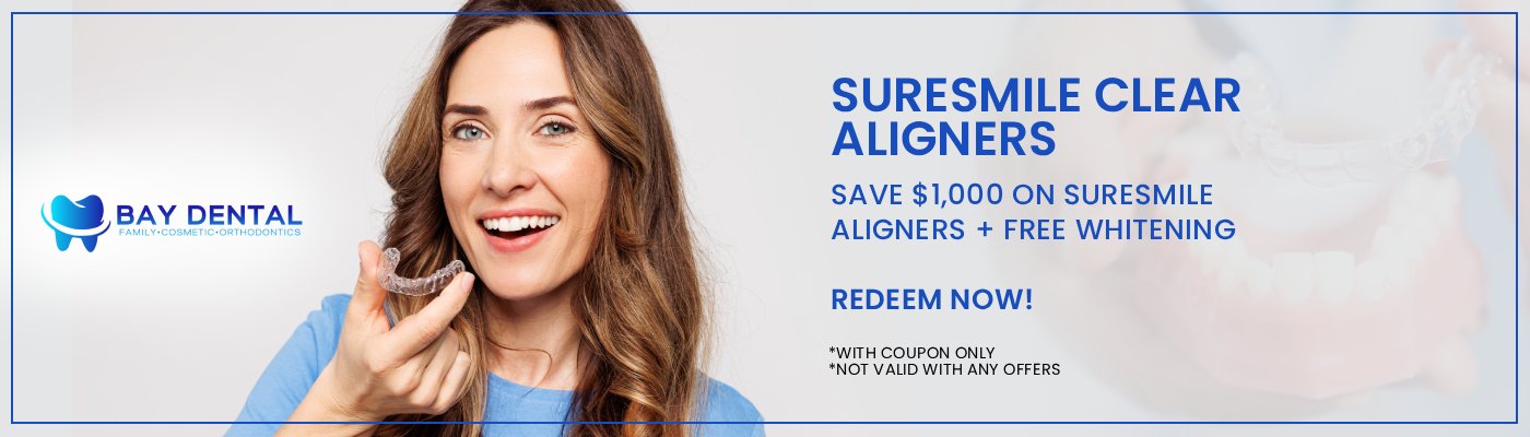 Clear Aligners Offer at Bay Dental in Santa Ana CA